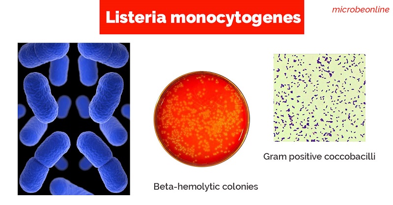 Vi khuẩn Listeria monocytogenes